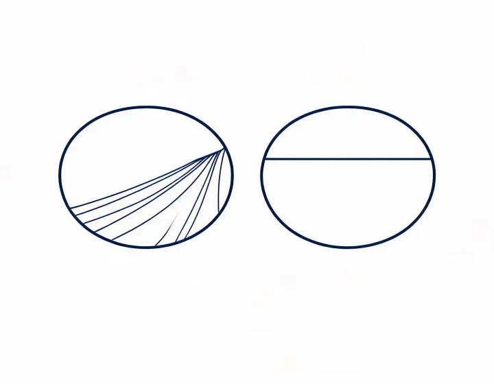 Side-by-side sketch comparing progressive corridor and bifocal segment layouts